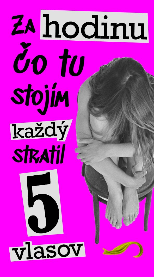 Časolepky