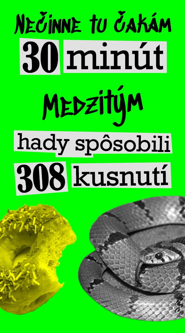 Časolepky